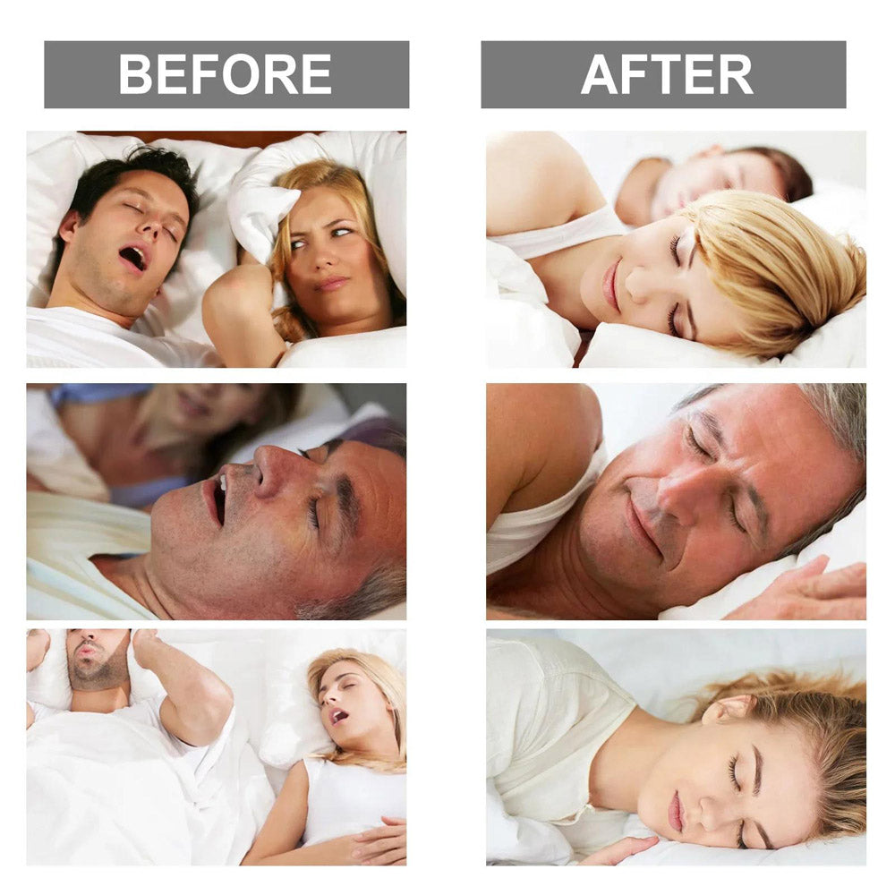 Sleep Aids Anti Snore Mouthpiece Mouth Guards Stop Snoring Adjustable Bruxisms